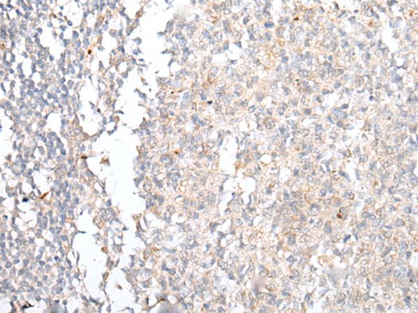 CCR4 Antibody