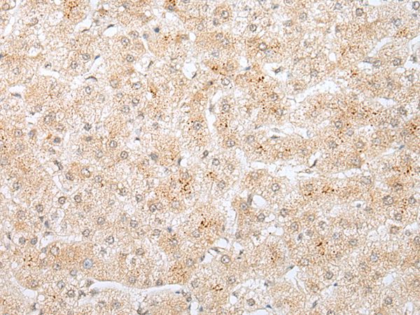 KRTAP11-1 Antibody