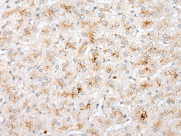 STK26 Antibody