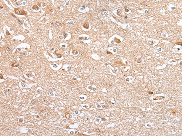 CES4A Antibody