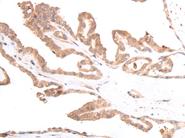 GLI3 Antibody