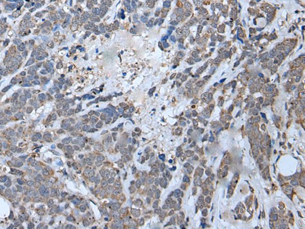 MYF6 Antibody