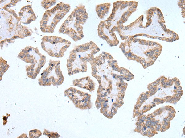 ABCD1 Antibody