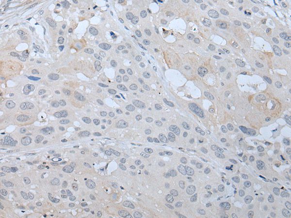 SST Antibody
