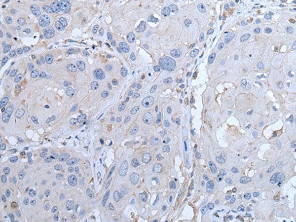 LTBP4 Antibody