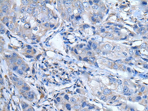LTBP4 Antibody