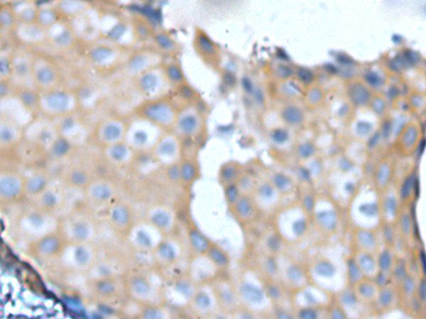 NF1 Antibody