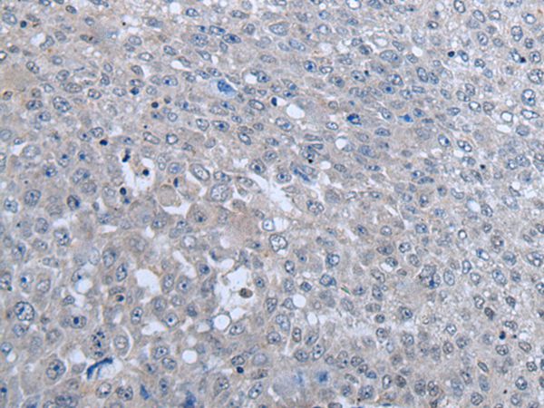MTHFR Antibody