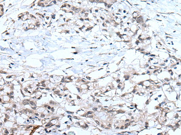 MTHFR Antibody