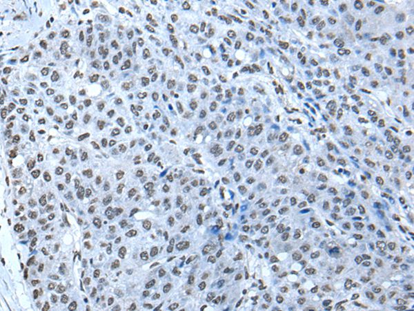 ZBTB4 Antibody