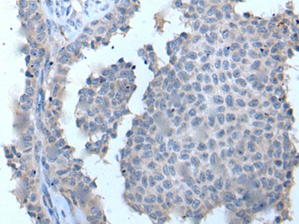 ZDHHC5 Antibody