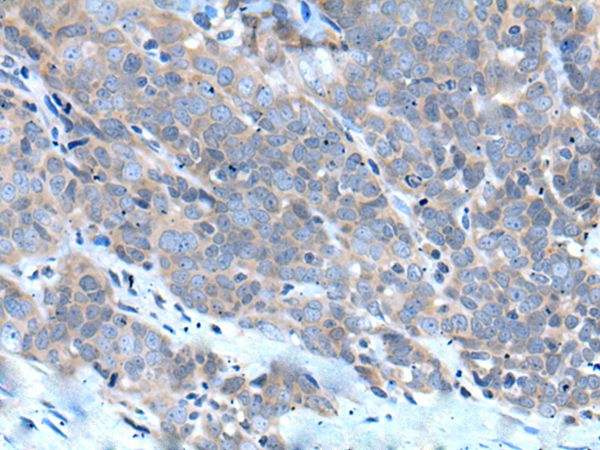 ZDHHC5 Antibody