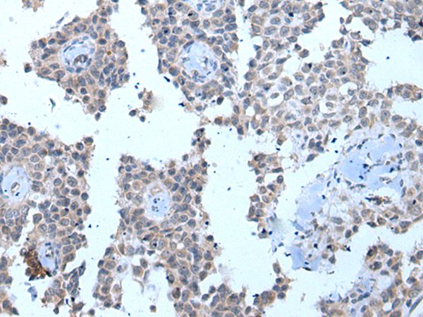 ZMYM2 Antibody