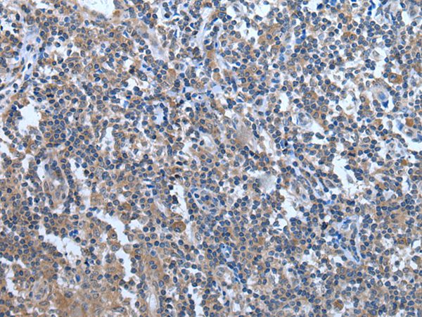 WDR11 Antibody