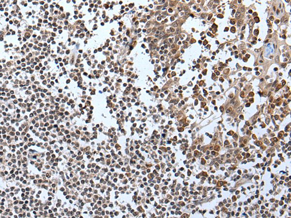 IWS1 Antibody