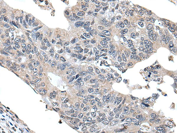 VPS36 Antibody