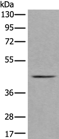 VPS36 Antibody