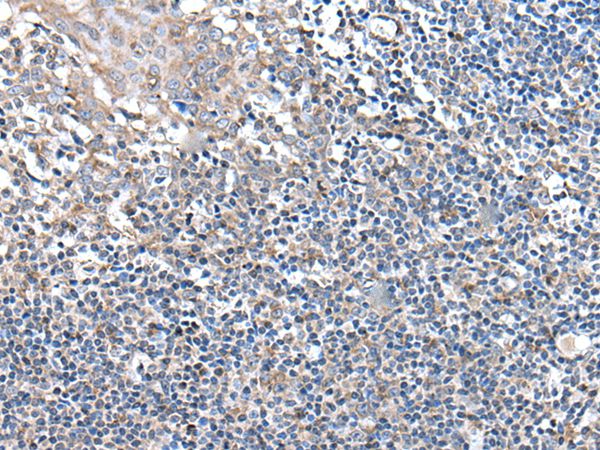 UBN2 Antibody