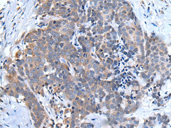 UBQLN2 Antibody