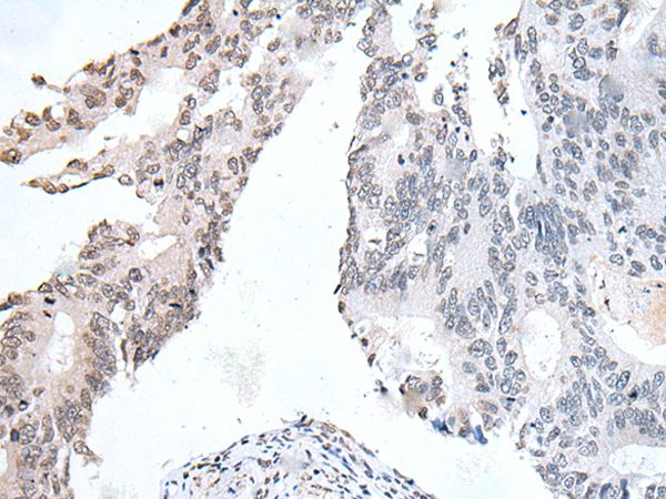 DSCC1 Antibody