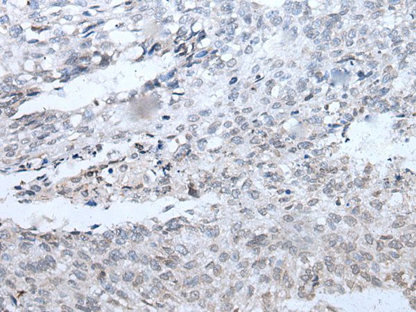 DSCC1 Antibody
