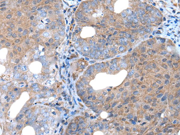 UNC5B Antibody