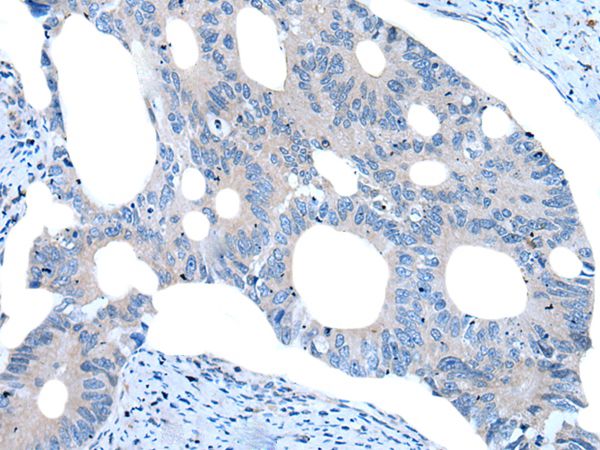 UNC5B Antibody