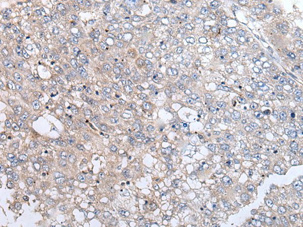 URGCP Antibody