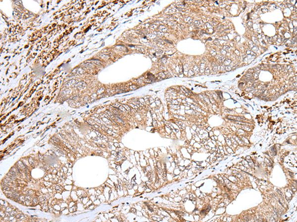 ENPEP Antibody