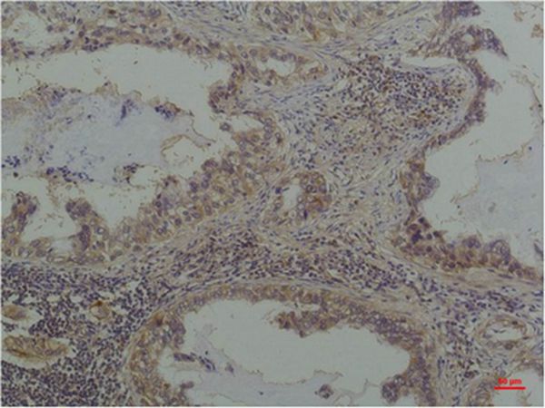 Phosphoserine Monoclonal Antibody(5B12)