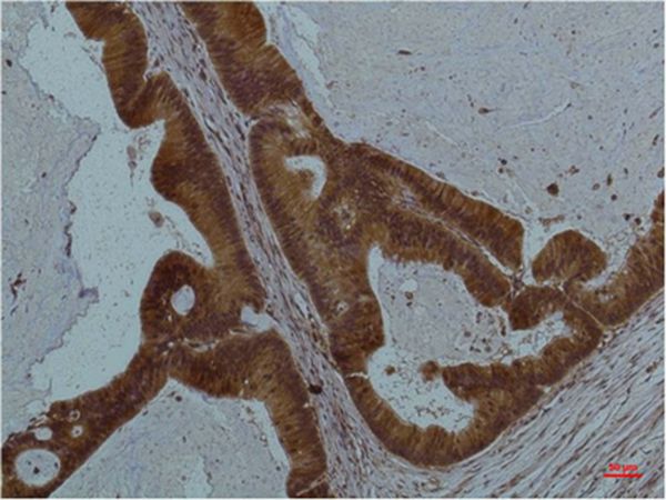 STAT3 Monoclonal Antibody(1E3)
