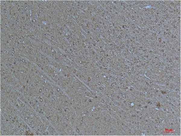 α-tubulin (Acetyl Lys40) Monoclonal Antibody(4A8)(4A8)