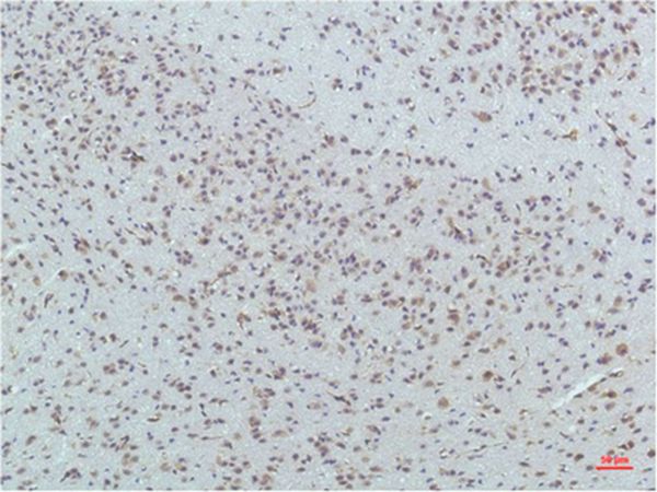 PPAR Delta Mouse Monoclonal Antibody(1D7)
