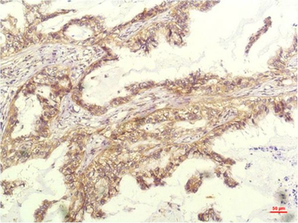 IL-8 Mouse Monoclonal Antibody(14E1)