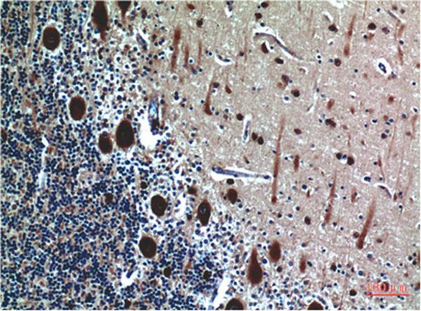 Cystatin C Mouse Monoclonal Antibody(5F1)