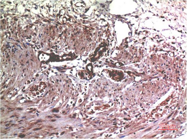 MMP2 Mouse Monoclonal Antibody(1H1)