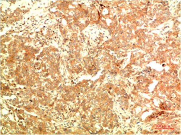 ATG5 Mouse Monoclonal Antibody(3C7)