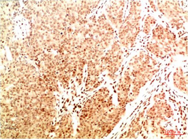 Acetyl NF kB P65(K314/K315) Mouse Monoclonal Antibody(2A11)