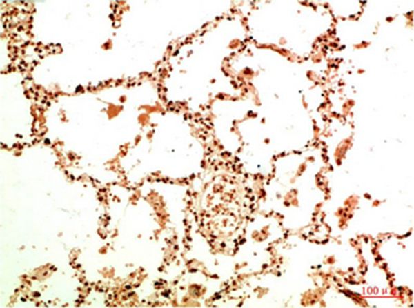 Acetyl NF kB P65(K314/K315) Mouse Monoclonal Antibody(5G11)