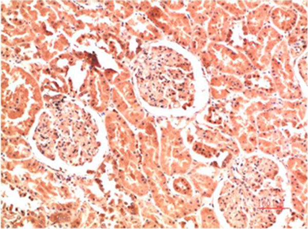 Collagen IV Mouse Monoclonal Antibody(4D1)