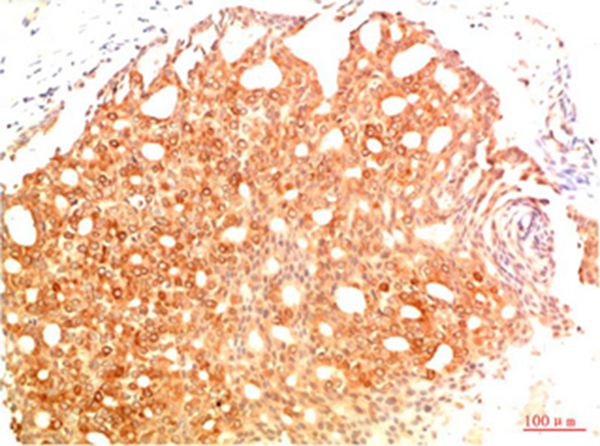 Acetyl P53(K382) Mouse Monoclonal Antibody(1G7)