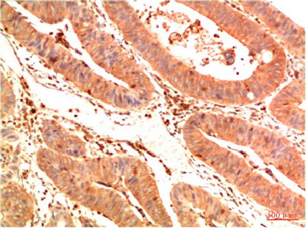 Acetyl P53(K382) Mouse Monoclonal Antibody(1G7)