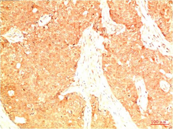Acetyl P53(K382) Mouse Monoclonal Antibody(15F4)