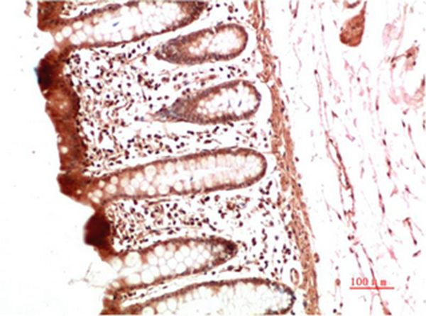 Collagen II Mouse Monoclonal Antibody(7F9) 