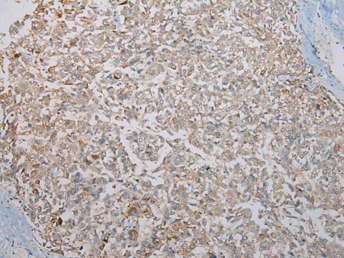 KCNH6 Antibody