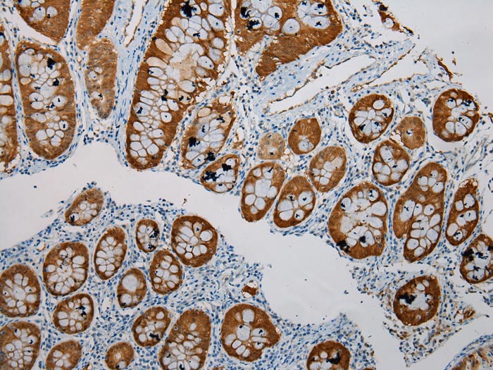 SULT1B1 Antibody
