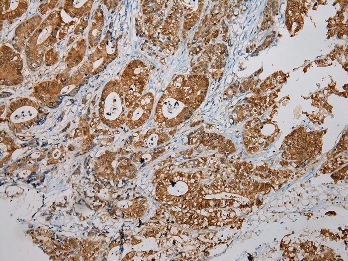 SULT1B1 Antibody