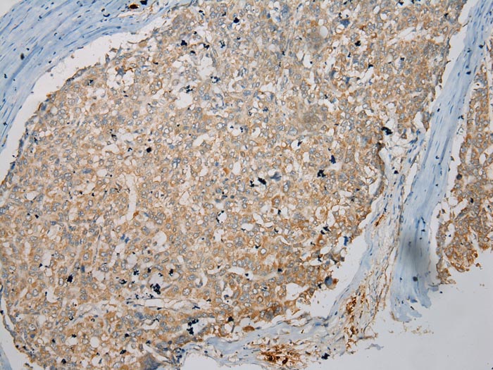 TPSB2 Antibody