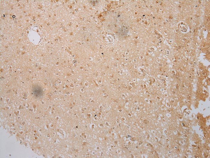 IL3RA Antibody
