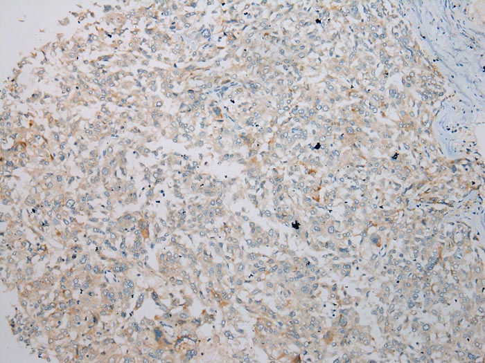 IL3RA Antibody